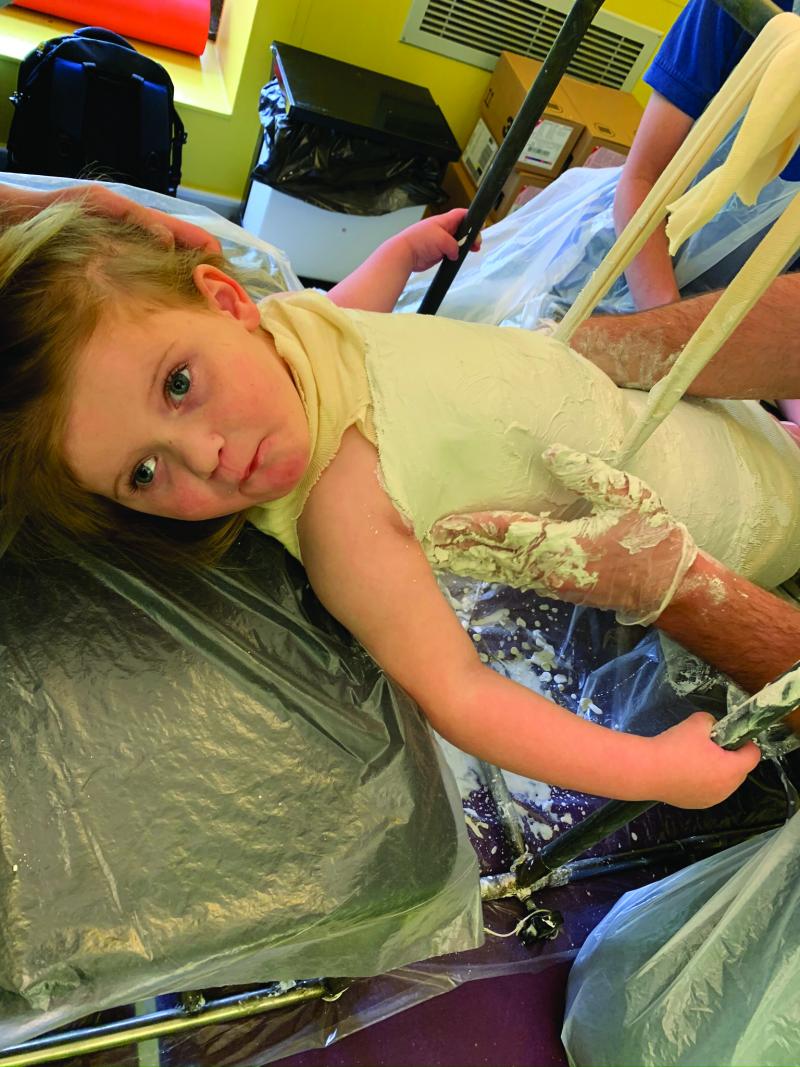 Mila having a cast made