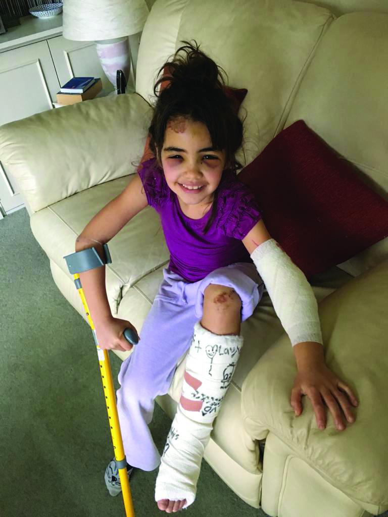 Savannah at home after her accident